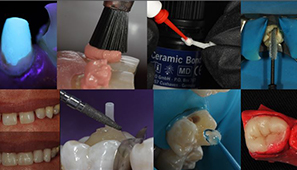 Curso de Odontologia Restauradora