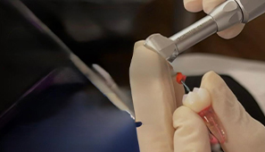 Simplificando o procedimento endodôntico