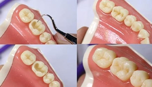 Imersão em anatomia dental