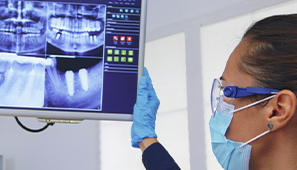 Imersão em Odontologia Digital