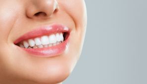 Clareamento dental clínico